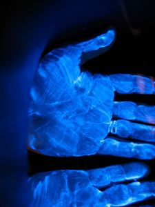 Dove e come trattare il bambino con dermatite atopic