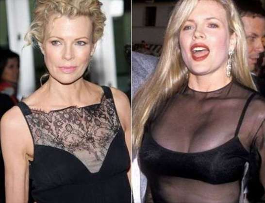 xl_now-then-8