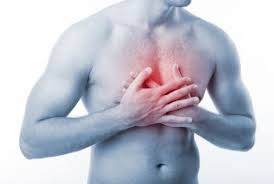 infarto8