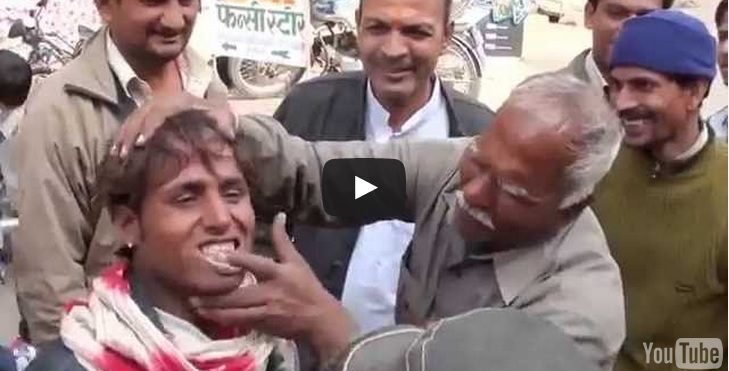 sbiancamento denti India