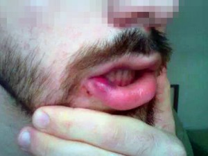 Napoli, pestaggio ragazzi gay: parla un testimone
