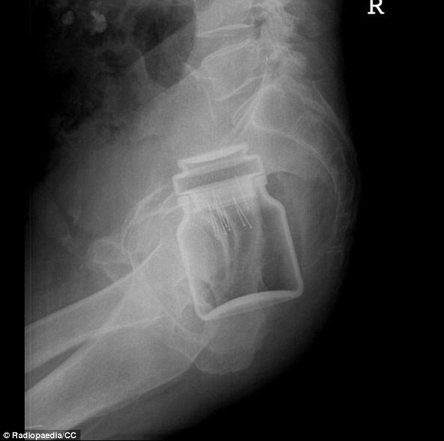 Radiopaedia1