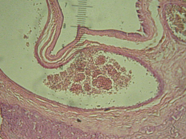 Placenta
