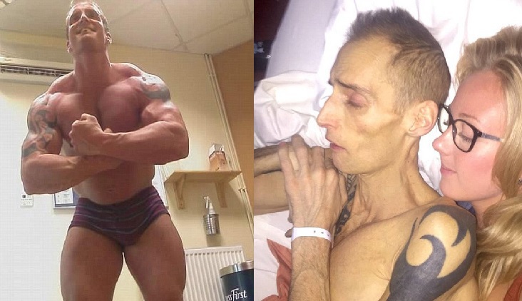 body builder tumore-3