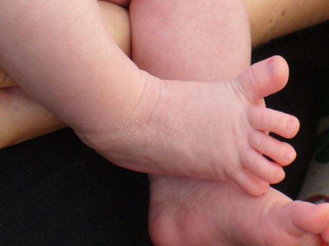 Babinski-newborn
