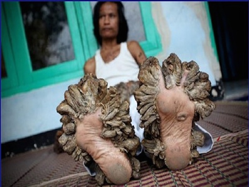 I-piedi-delluomo-albero