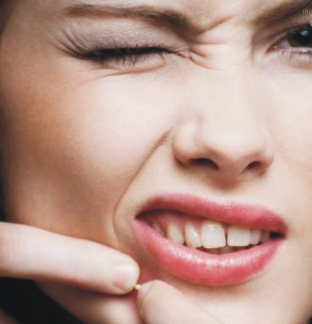 Un modo naturale per curare l' acne in 3 giorni