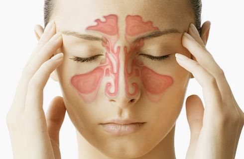 Quali sono sintomi della sinusite mascellare