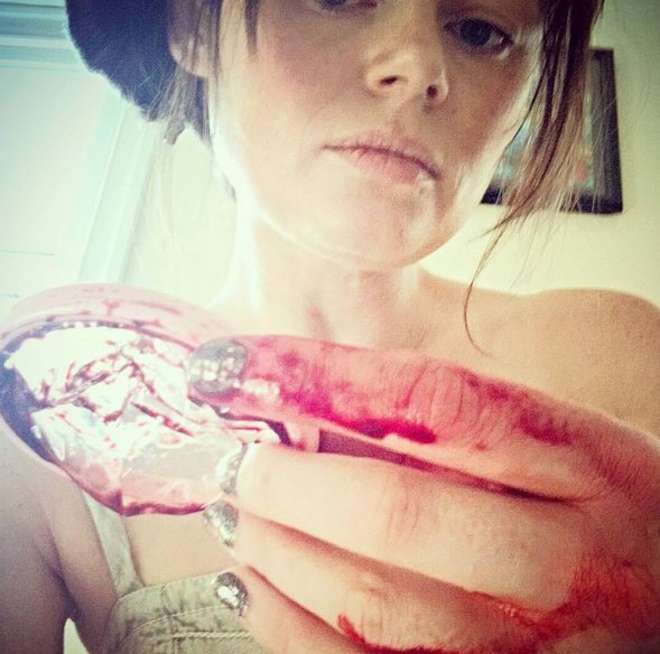 Pubblica una foto disgustosa su Instagram: gli utenti la minacciano di morte