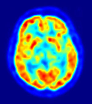 Obama: Mappatura del cervello umano