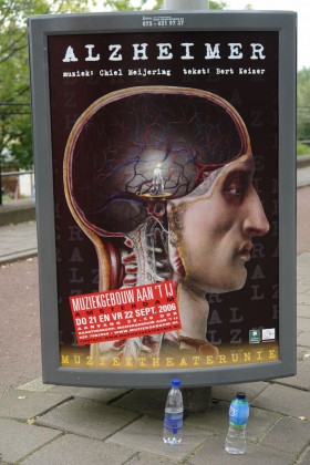 Il rame causa dell'Alzheimer?