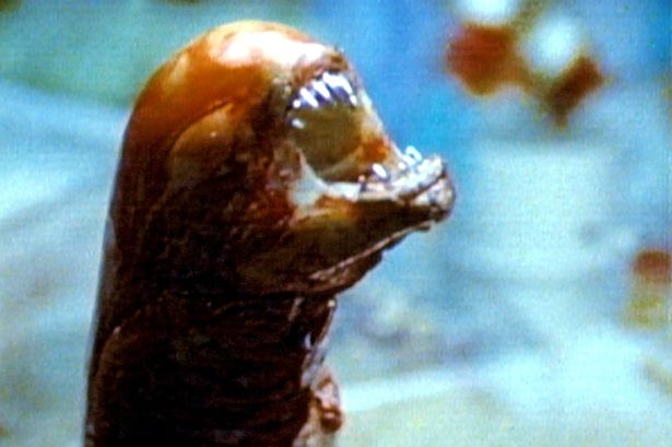 Uomo 'partorisce' il suo gemello parassitario