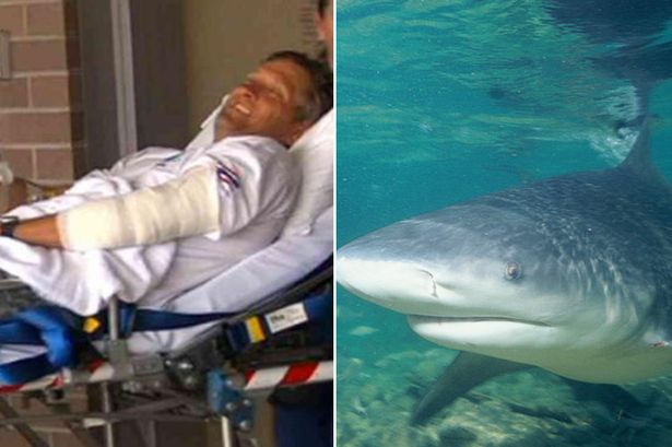 Surfista morso da uno squalo si salva prendendolo a pugni
