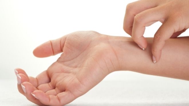 Come trattare una reazione allergica cutanea