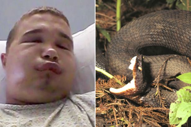 Ecco perchè non bisogna mai baciare un serpente velenoso