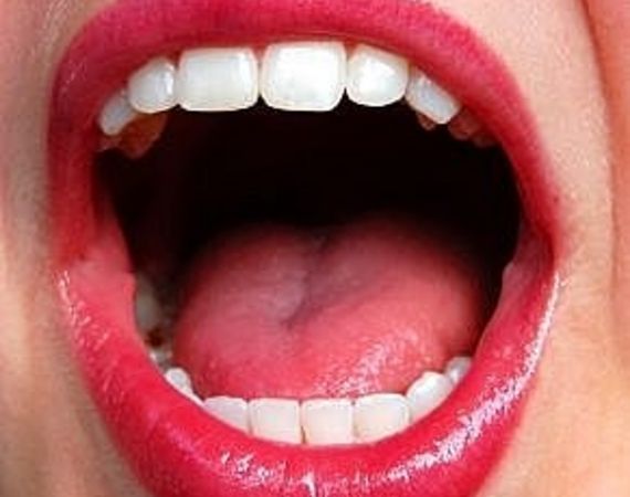 Come sbarazzarsi di un accento!