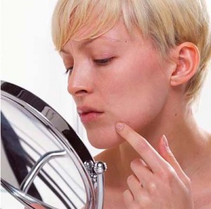 Come trattare l' acne ormonale