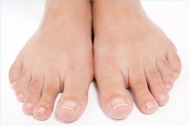 Come disinfettare una pietra pomice