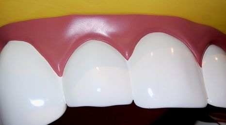 Come sbiancare i denti con acqua ossigenata