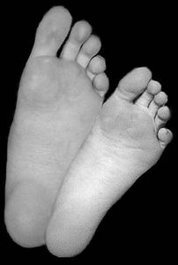 Come depurarsi attraverso i piedi