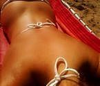 Come fare un trattamento per una grave scottatura solare