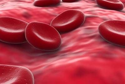I sintomi più comuni dell'anemia