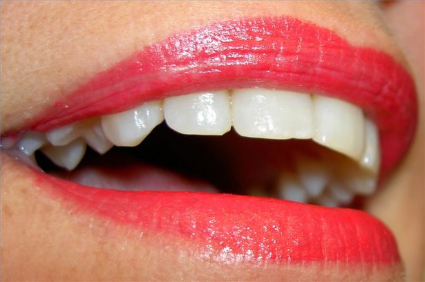 Rimedi casalinghi per denti più bianchi