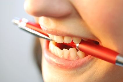 Come sbiancare i denti in un giorno