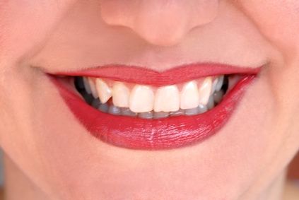 Come liberarsi di un'infezione ai denti
