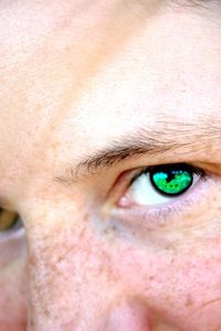 Come liberare il vostro viso dalle lentiggini