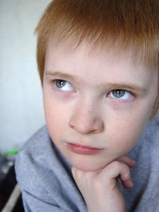 Come liberarsi delle lentiggini in meno di una settimana