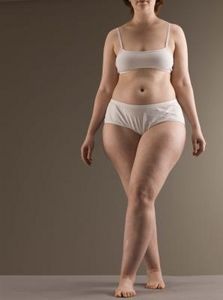Come nascondere istantaneamente la cellulite sulle gambe