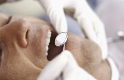 Come riconoscere i sintomi di un ascesso dentale