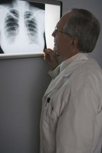 Segni dell'Osteoporosi