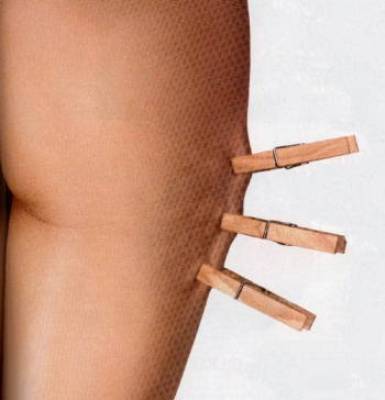 Come combattere le smagliature