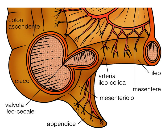 Sintomi di una diverticolite cecale