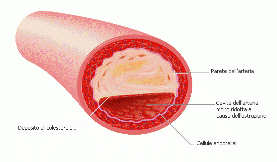Cibi che alzano il livello di colesterolo