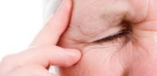 Trattamento dell'emicrania oculare