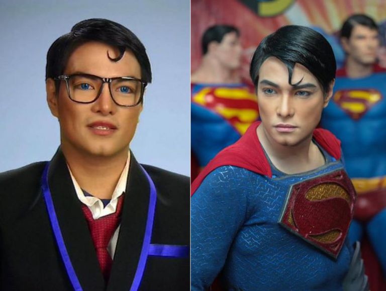 Un uomo subisce 23 interventi chirurgici per diventare come Superman