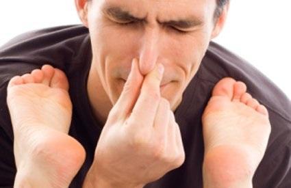 Che cos’è la bromidrosi dei piedi?