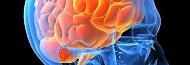 Cambiamenti nel cervello a causa della schizofrenia