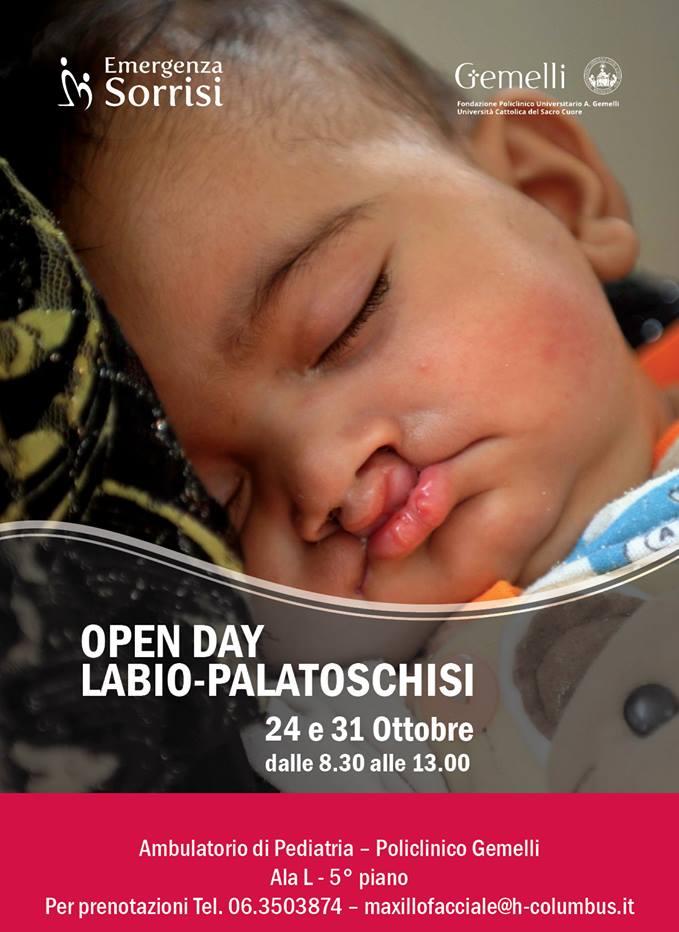 Policlinico Gemelli: open day labio-palatoschisi