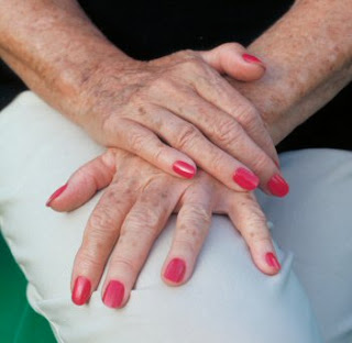 Come sbarazzarsi delle macchie scure sul corpo