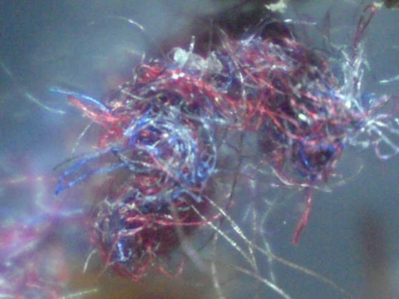Che cos’è il morbo di Morgellons