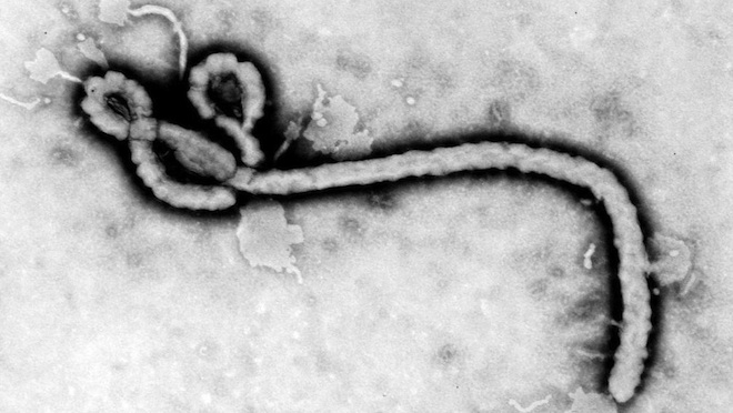 Come prevenire virus ebola