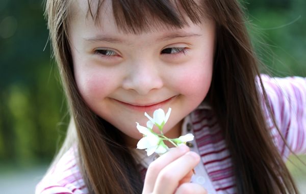 Una bimba affetta da sindrome di down Una bimba affetta da sindrome di down