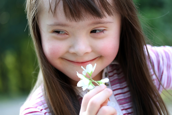 Una bimba affetta da sindrome di down Una bimba affetta da sindrome di down