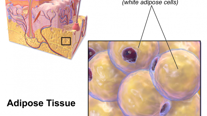 cellulite cellulite