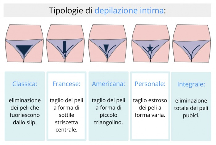 TIPOLOGIE DEPILAZIONE INTIMA. TIPOLOGIE DEPILAZIONE INTIMA.