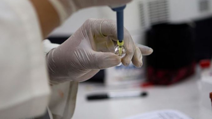 esami virus zika
